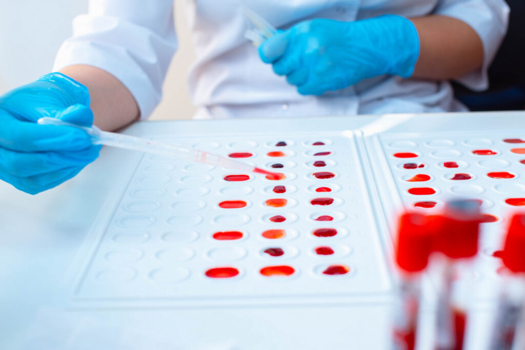 How to Schedule a Home Sample Collection for Medical Tests in Dubai