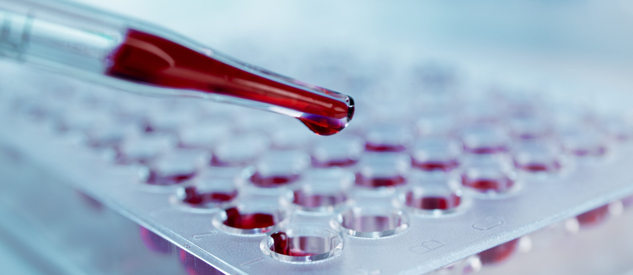Home Sample Collection for Medical Tests