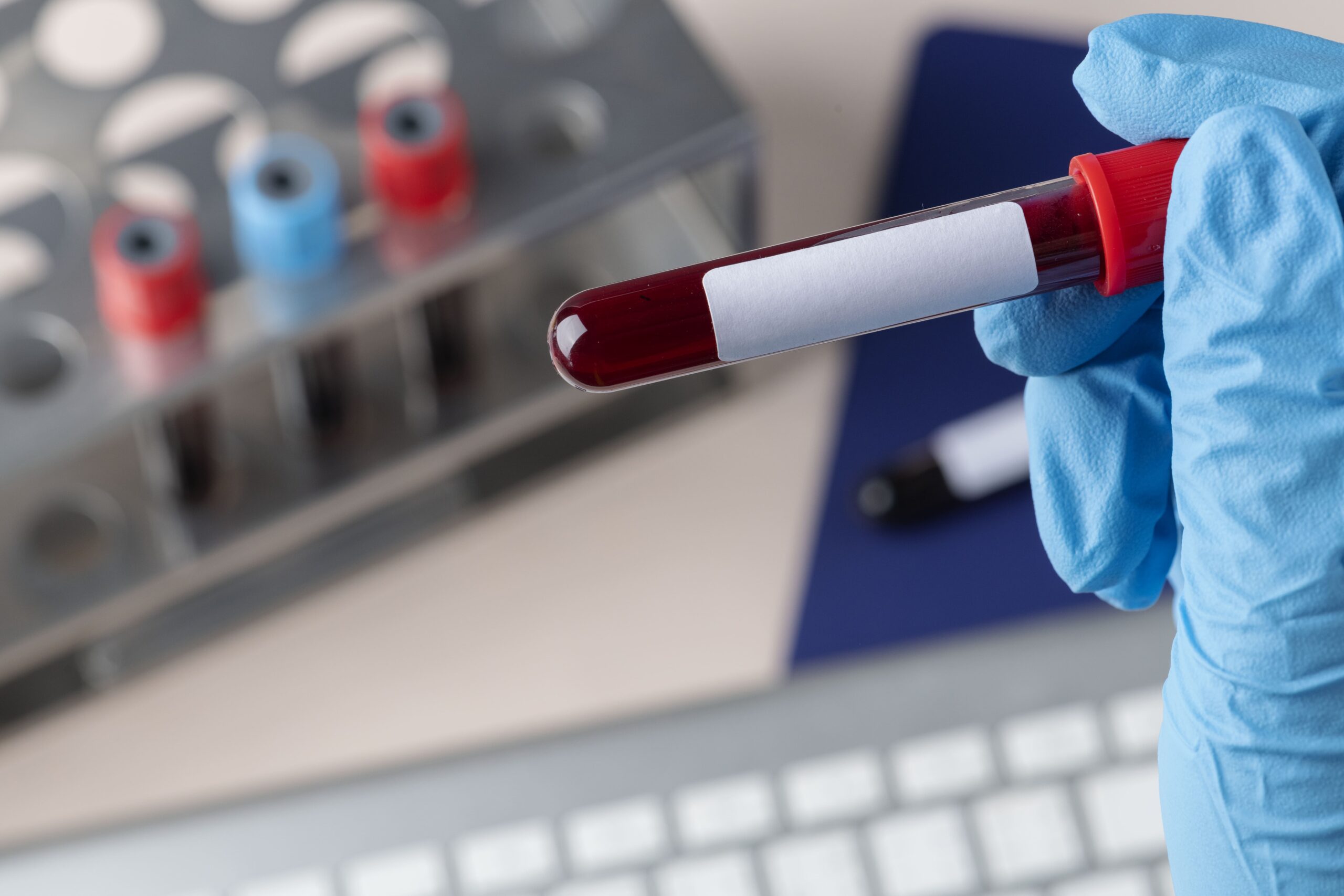 How to Schedule a Home Sample Collection for Medical Tests in Dubai
