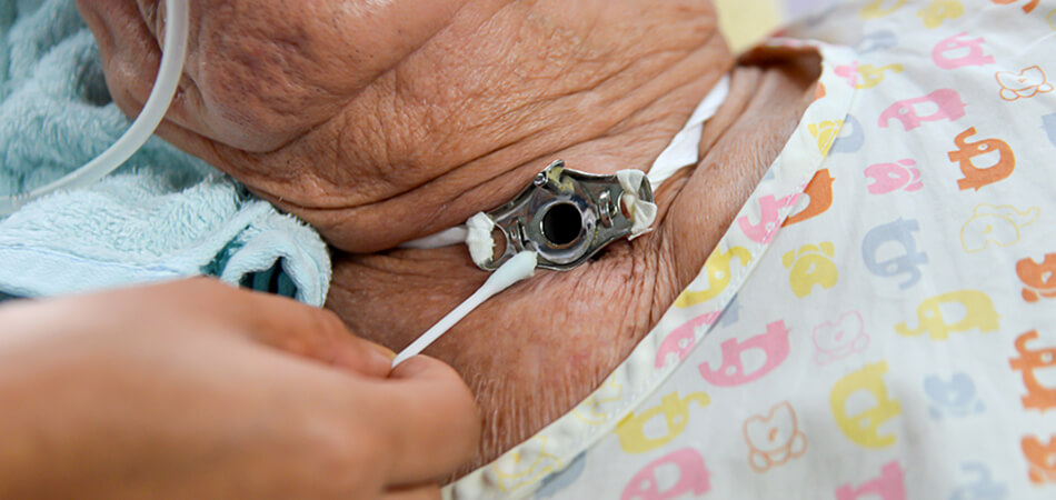 Tracheostomy Care at Home dubai