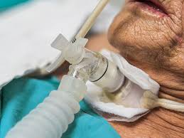 Who Needs In-Home Tracheostomy Care?