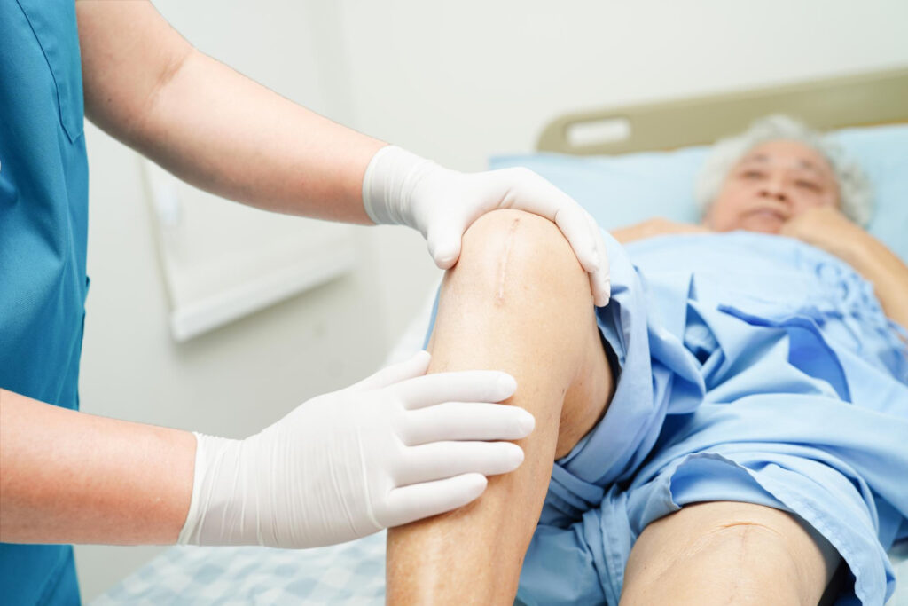 Knee Replacement Home Care and Recovery Support in Dubai